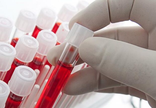 krvni test po pitju alkohola